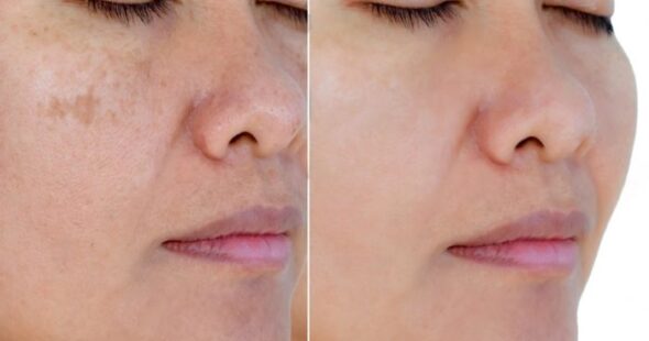 Squareroot clinics